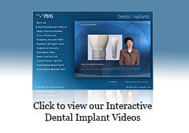 Presentación Implantes Dentales